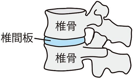 椎間板 