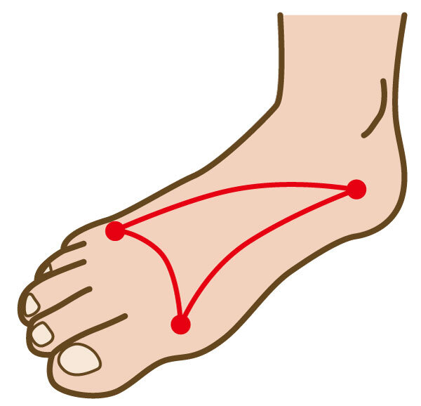 足アーチの図